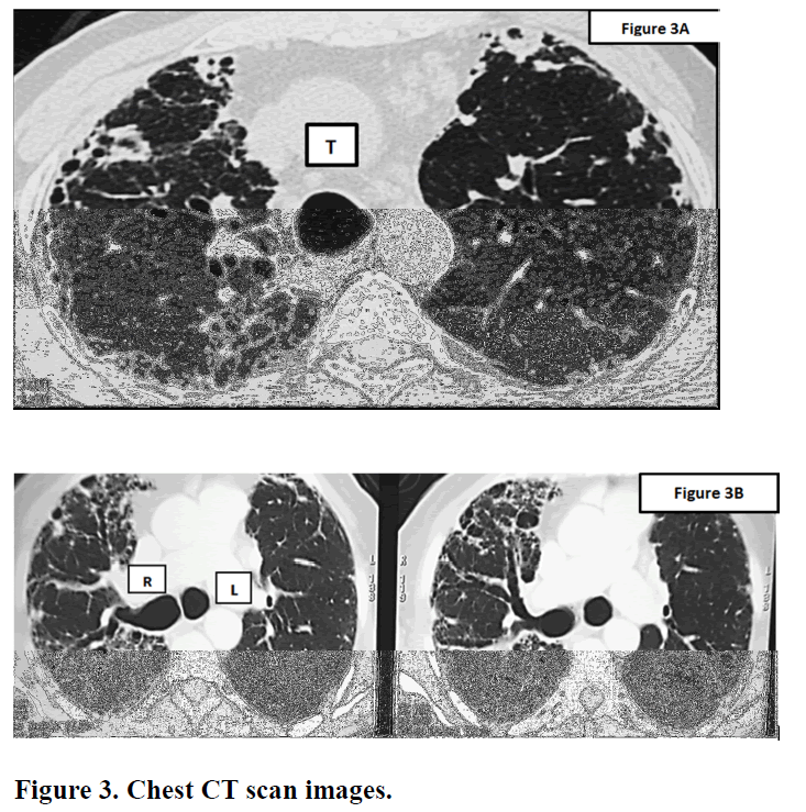 imaging-in-medicine-CT-scan