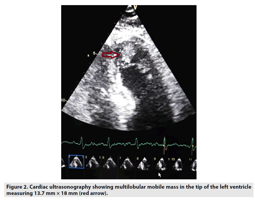 imaging-in-medicine-Cardiac-ultrasonography