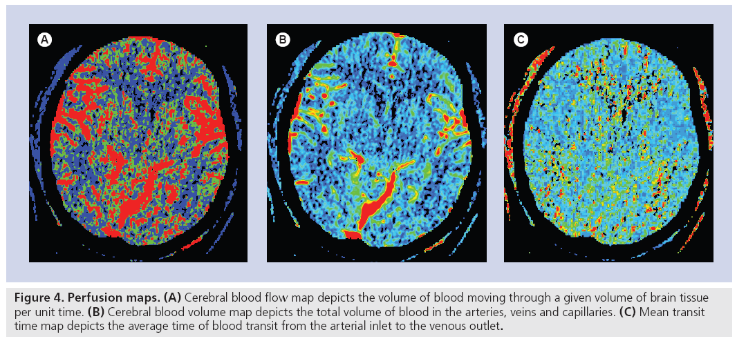 imaging-in-medicine-Cerebral-blood