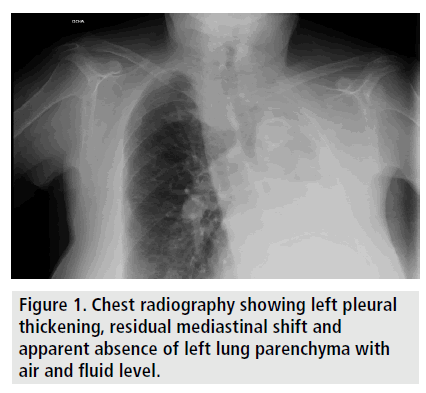 imaging-in-medicine-Chest-radiography