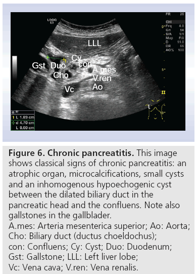 pancreas ultrasound