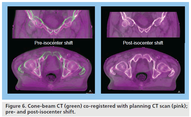 imaging-in-medicine-Cone-beam