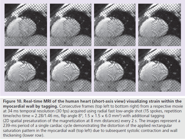 imaging-in-medicine-Consecutive-frames