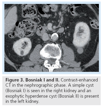 imaging-in-medicine-Contrast-enhanced