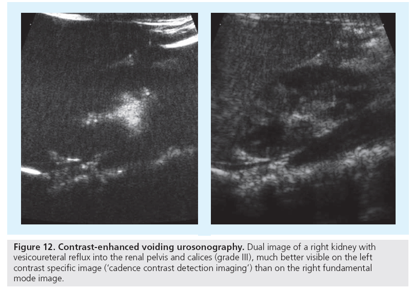 imaging-in-medicine-Contrast-enhanced