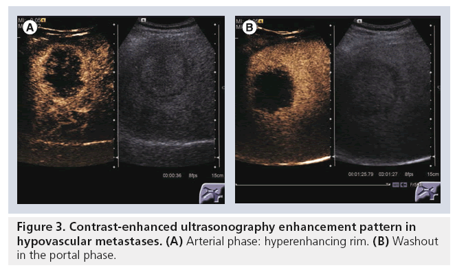 imaging-in-medicine-Contrast-enhanced