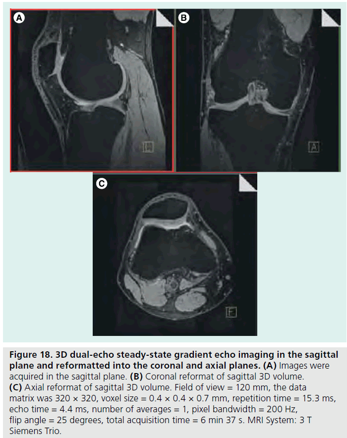 imaging-in-medicine-Coronal-reformat