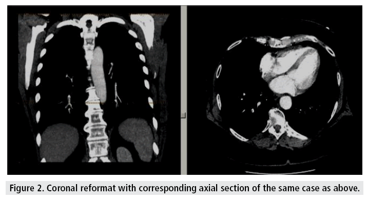 imaging-in-medicine-Coronal-reformat