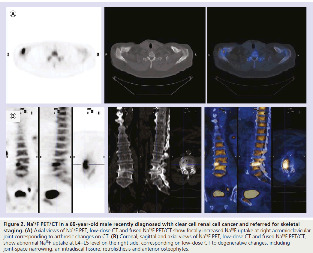 imaging-in-medicine-Coronal-sagittal