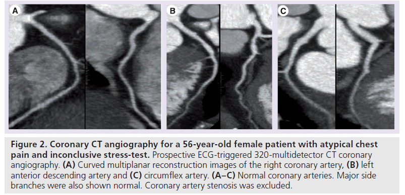 imaging-in-medicine-Curved-multiplanar