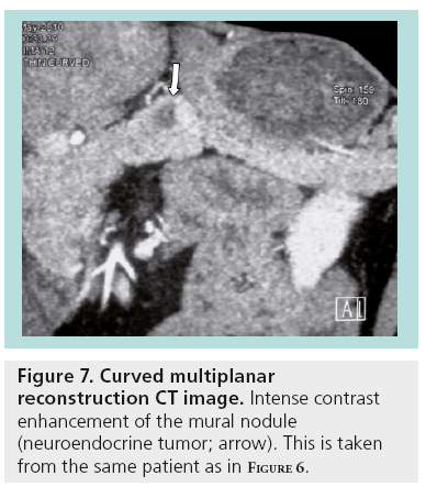 imaging-in-medicine-Curved-multiplanar