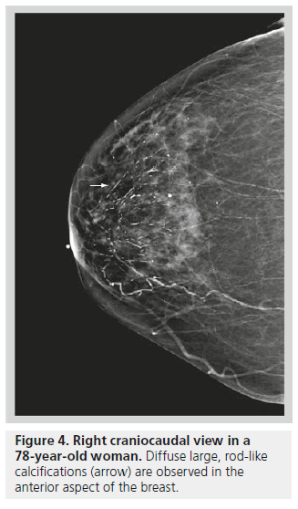 imaging-in-medicine-Diffuse-large