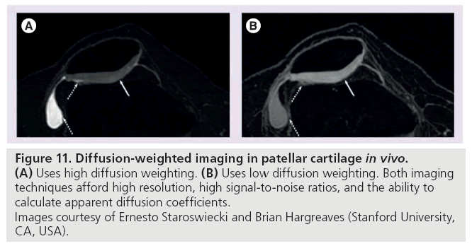imaging-in-medicine-Diffusion-weighted