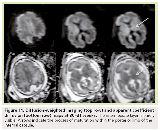 imaging-in-medicine-Diffusion-weighted