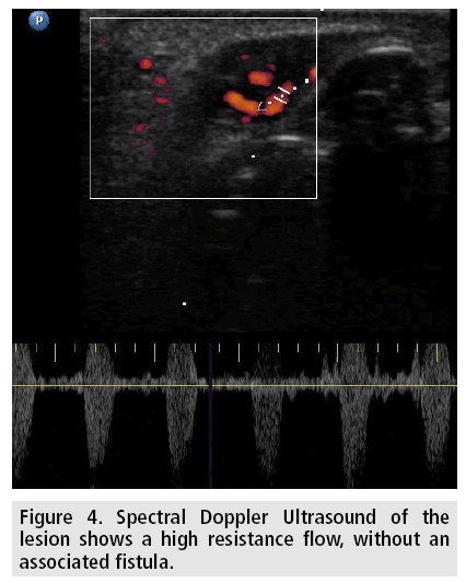 imaging-in-medicine-Doppler
