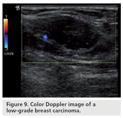 imaging-in-medicine-Doppler-image