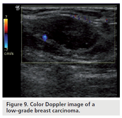 Doppler Ultrasound Color Chart