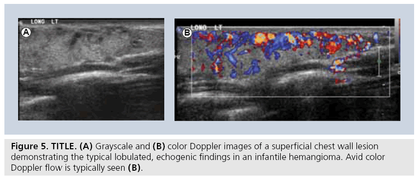 imaging-in-medicine-Doppler-images