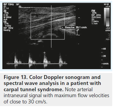 imaging-in-medicine-Doppler-sonogram