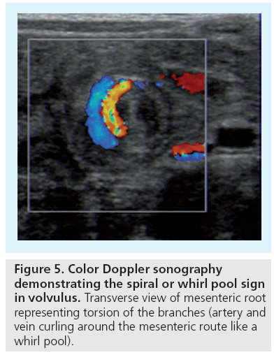 imaging-in-medicine-Doppler-sonography