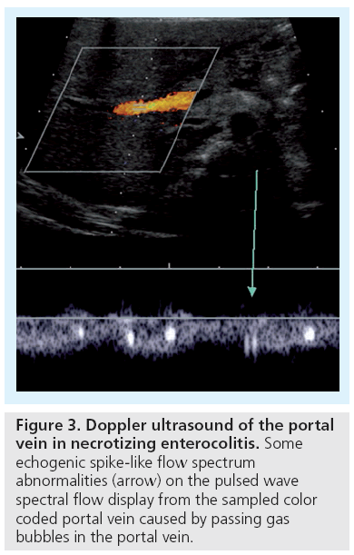imaging-in-medicine-Doppler-ultrasound