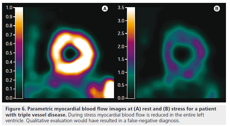 imaging-in-medicine-During-stress