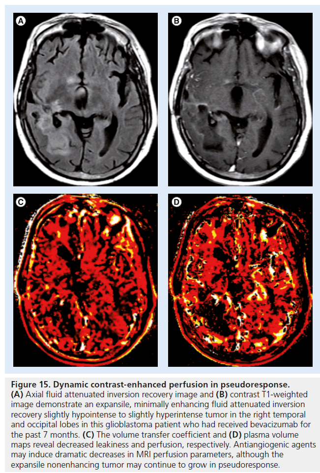 imaging-in-medicine-Dynamic-contrast