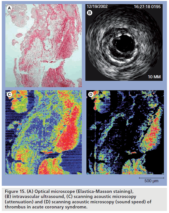 imaging-in-medicine-Elastica-Masson