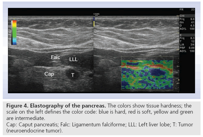 imaging-in-medicine-Elastography