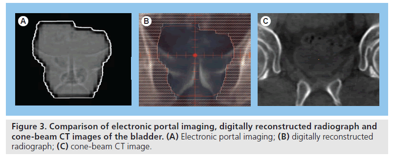 imaging-in-medicine-Electronic-portal
