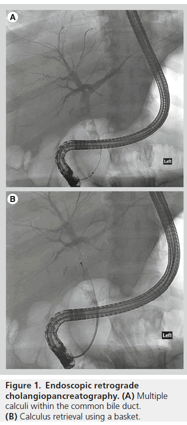 imaging-in-medicine-Endoscopic-retrograde