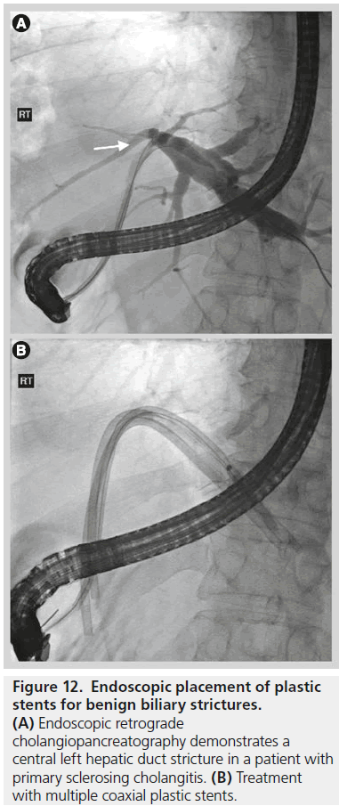 imaging-in-medicine-Endoscopic-retrograde