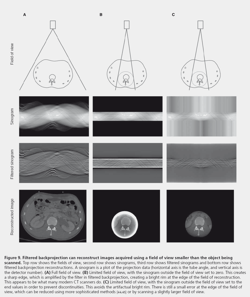 imaging-in-medicine-Filtered-backprojection