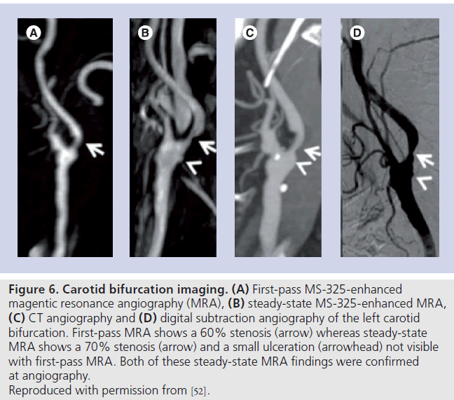 imaging-in-medicine-First-pass