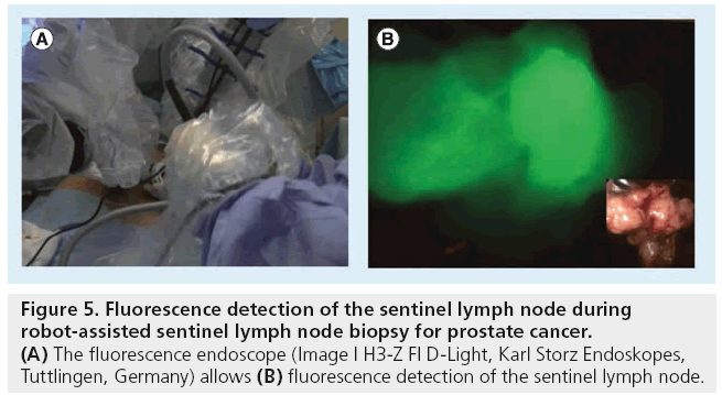 imaging-in-medicine-Fluorescence-detection
