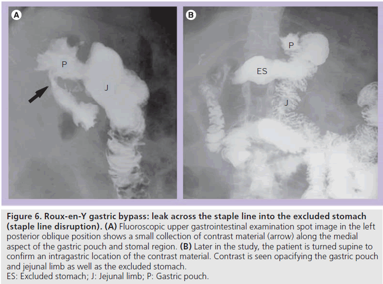 imaging-in-medicine-Fluoroscopic-upper