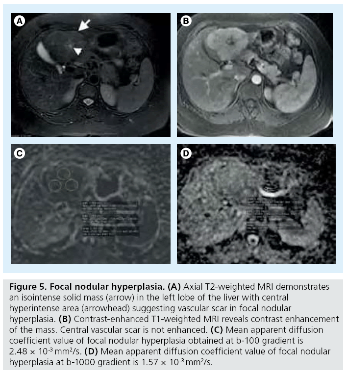 imaging-in-medicine-Focal-nodular