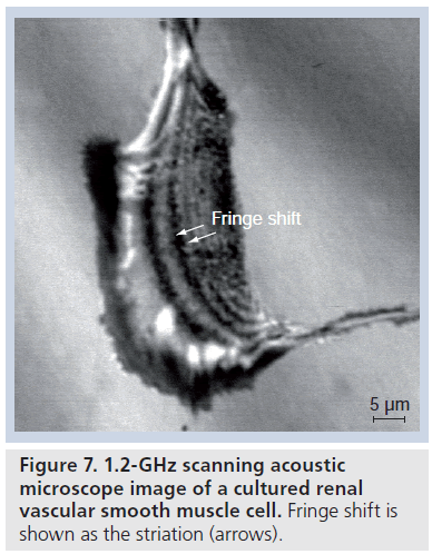 imaging-in-medicine-Fringe-shift