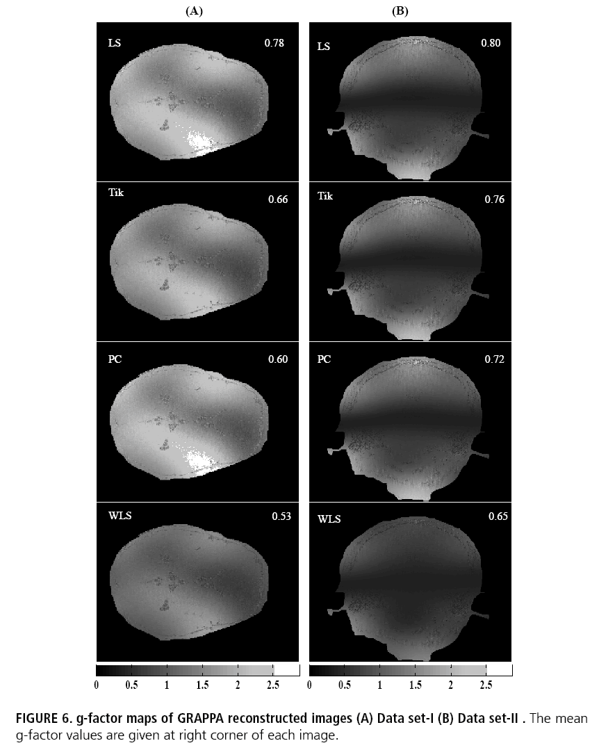 imaging-in-medicine-GRAPPA