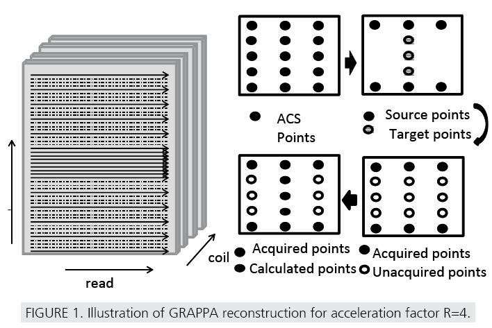 imaging-in-medicine-GRAPPA-reconstruction