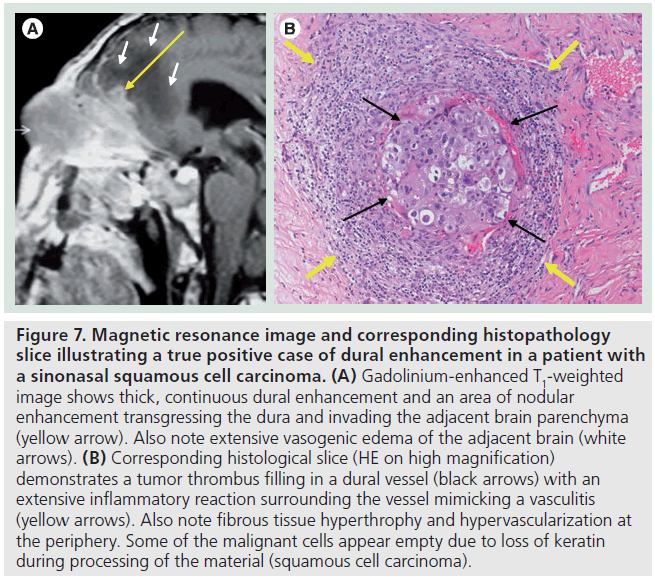 imaging-in-medicine-Gadolinium-enhanced