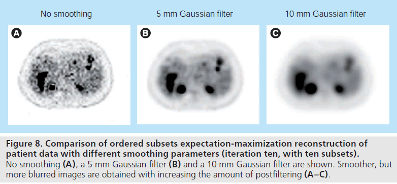 imaging-in-medicine-Gaussian-filter