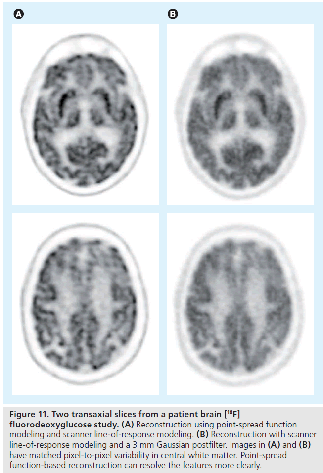 imaging-in-medicine-Gaussian-postfilter