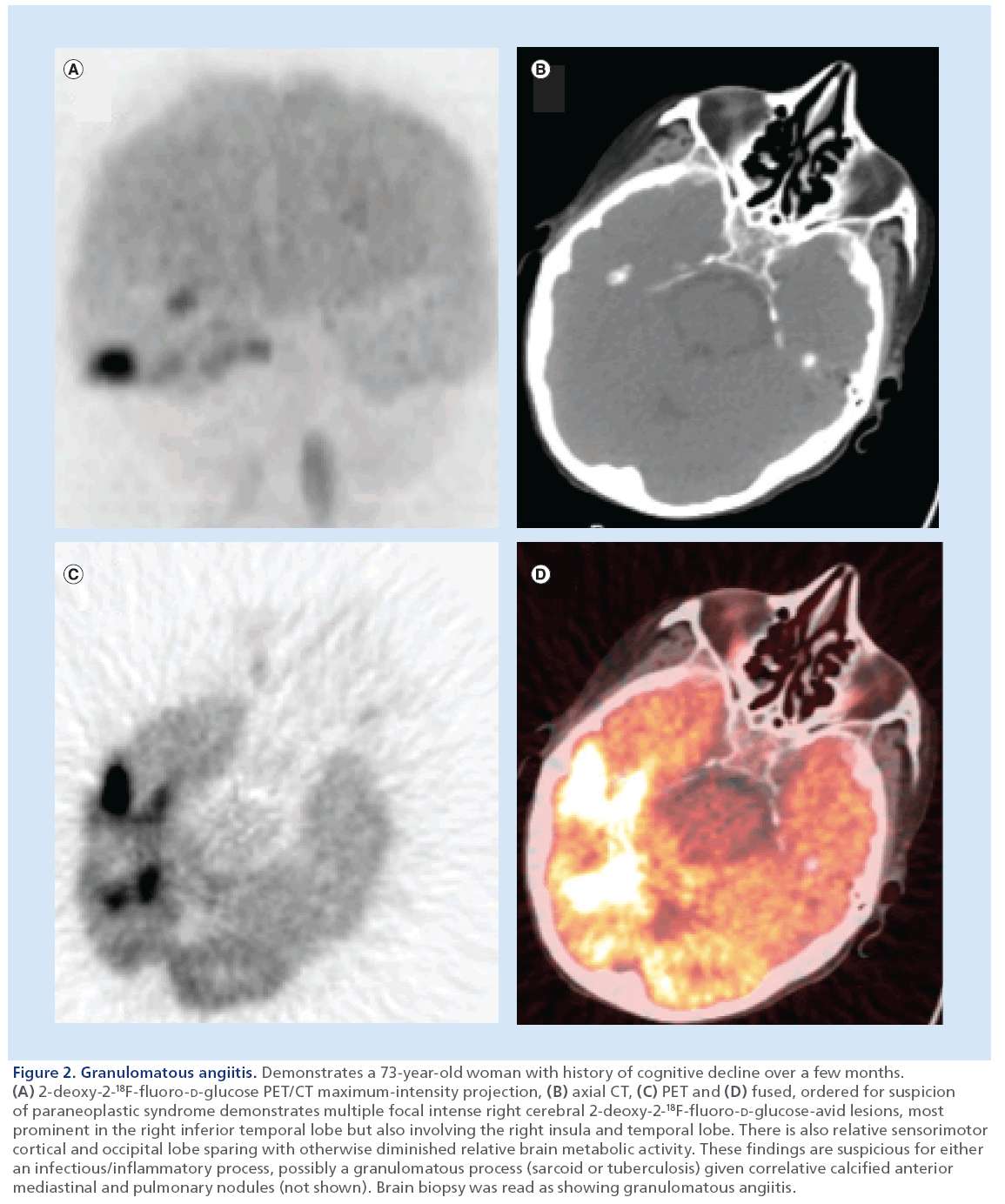 imaging-in-medicine-Granulomatous