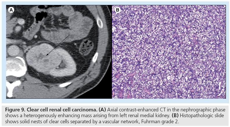 imaging-in-medicine-Histopathologic-slide