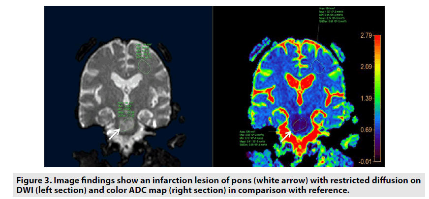 imaging-in-medicine-Image-findings