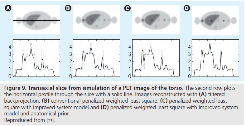 imaging-in-medicine-Images-reconstructed