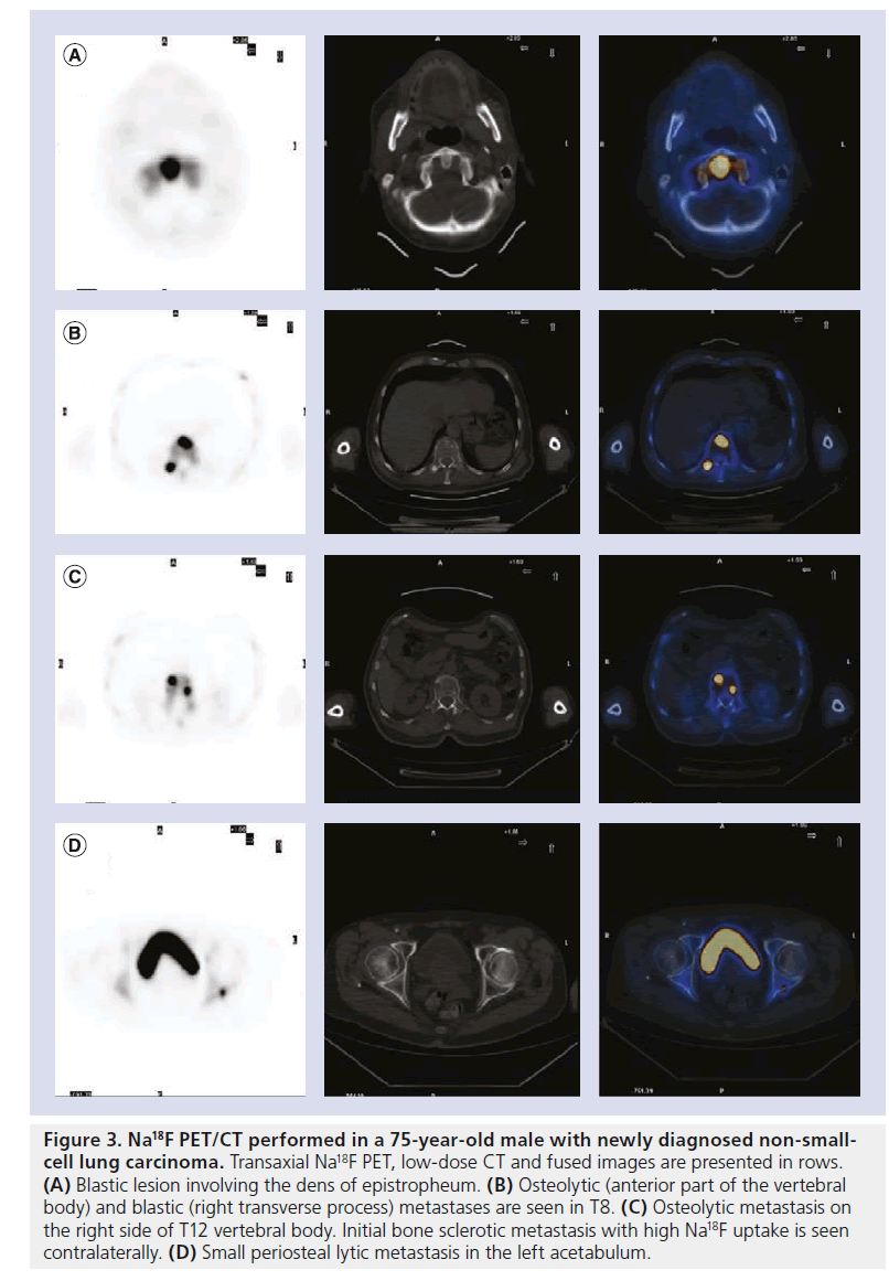 imaging-in-medicine-Initial-bone
