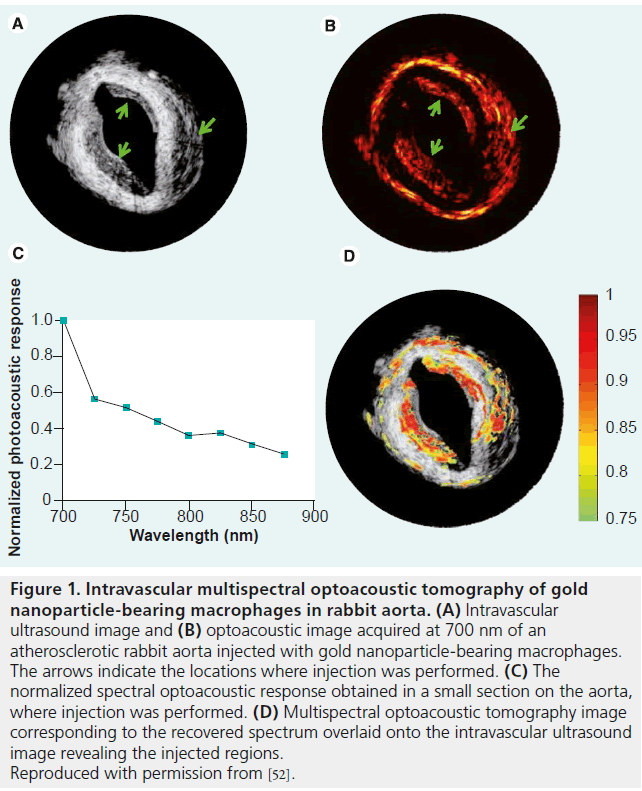 imaging-in-medicine-Intravascular-multispectral