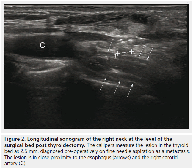 imaging-in-medicine-Longitudinal-sonogram